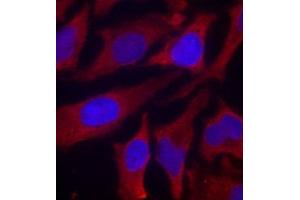 Immunofluorescence staining of methanol-fixed Hela cells using Phospho-SYN1-S9 antibody. (SYN1 抗体  (pSer9))