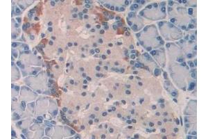 Immunohistochemistry (IHC) image for anti-Interleukin 18 (IL18) (AA 37-194) antibody (ABIN7429634)