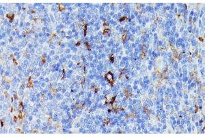 Immunohistochemistry of paraffin-embedded Rat spleen using MMP25 Polyclonal Antibody at dilution of 1:100 (40x lens). (MMP25 抗体)