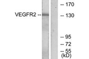 Western blot analysis of extracts from K562 cells, treated with LPS 100ng/ml 30', using VEGFR2 (Ab-1175) Antibody. (VEGFR2/CD309 抗体  (AA 1141-1190))
