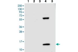 Western blot analysis of Lane 1: RT-4, Lane 2: U-251 MG, Lane 3: Human Plasma, Lane 4: Liver, Lane 5: Tonsil with PPP4R4 polyclonal antibody  at 1:250-1:500 dilution. (PPP4R4 抗体)