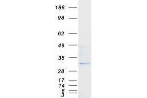 Western Blotting (WB) image for Vanin 3 (VNN3) (Transcript Variant 1) protein (Myc-DYKDDDDK Tag) (ABIN2735175)
