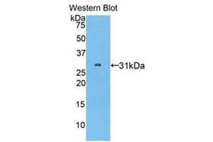 Western Blotting (WB) image for anti-Pitrilysin Metallopeptidase 1 (PITRM1) (AA 544-806) antibody (ABIN1859866) (PITRM1 抗体  (AA 544-806))