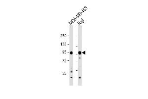 All lanes : Anti-AXIN1 Antibody (C-term) at 1:1000 dilution Lane 1: MDA-MB-453 whole cell lysate Lane 2: Raji whole cell lysate Lysates/proteins at 20 μg per lane. (Axin 抗体  (C-Term))