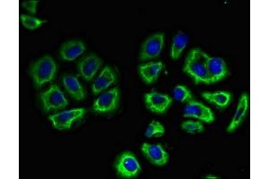 Immunofluorescent analysis of A549 cells using ABIN7161482 at dilution of 1:100 and Alexa Fluor 488-congugated AffiniPure Goat Anti-Rabbit IgG(H+L) (SLC3A1 抗体  (AA 1-68))