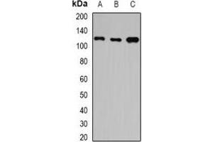 Western blot analysis of HIP1 expression in A549 (A), SW480 (B), mouse brain (C) whole cell lysates. (HIP1 抗体)