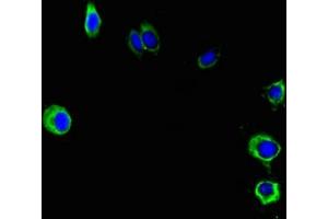 Immunofluorescent analysis of Hela cells using ABIN7162692 at dilution of 1:100 and Alexa Fluor 488-congugated AffiniPure Goat Anti-Rabbit IgG(H+L) (PNPLA2 抗体  (AA 1-504))