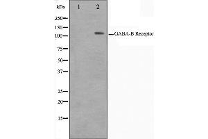 Western blot analysis on HeLa cell lysate using GABBR1 Antibody,The lane on the left is treated with the antigen-specific peptide. (GABBR1 抗体  (C-Term))