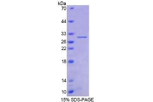SDS-PAGE analysis of Human AGA Protein. (AGA 蛋白)