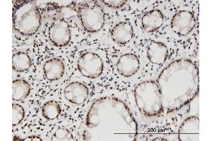Immunostaining (ISt) image for anti-DiGeorge Syndrome Critical Region Gene 8 (DGCR8) (AA 675-771) antibody (ABIN527086)