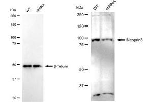 Western blotting analysis using Nesprin3 antibody (ABIN7798074). (Recombinant Nesprin3 抗体)