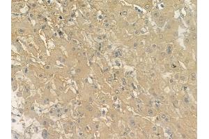 ABIN6262980 and ABIN6272946 at 1/100 staining human normal liver tissue by IHC-P. (PPFIA1 抗体  (C-Term))