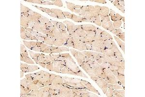 Immunohistochemistry (Paraffin-embedded Sections) (IHC (p)) image for anti-Palladin, Cytoskeletal Associated Protein (PALLD) antibody (ABIN7074976)