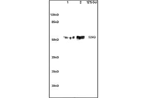 SDS-PAGE (SDS) image for anti-Solute Carrier Family 2 (Facilitated Glucose Transporter) Member 8 (SLC2A8) (AA 401-477) antibody (ABIN705746)