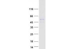 Western Blotting (WB) image for Solute Carrier Family 22 Member 18 (SLC22A18) (Transcript Variant 2) protein (Myc-DYKDDDDK Tag) (ABIN2732154)