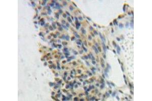 Immunohistochemistry (IHC) image for anti-General Transcription Factor IIE, Polypeptide 1, alpha 56kDa (GTF2E1) (AA 15-306) antibody (ABIN7443038)