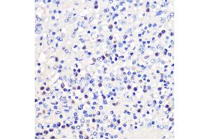 Immunohistochemistry (IHC) image for anti-Tumor Necrosis Factor Receptor Superfamily, Member 9 (TNFRSF9) (AA 150-250) antibody (ABIN7271073)