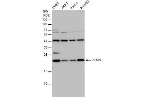 WB Image DUSP3 antibody detects DUSP3 protein by western blot analysis. (Dual Specificity Phosphatase 3 (DUSP3) 抗体)