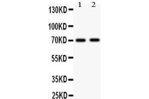 Anti-MEKK3 antibody, Western blotting All lanes: Anti MAP3K3  at 0. (MAP3K3 抗体  (N-Term))