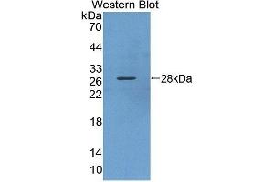 Detection of Recombinant KPNa3, Human using Polyclonal Antibody to Karyopherin Alpha 3 (KPNa3) (KPNA3 抗体  (AA 3-220))