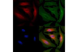 ABIN6261736 and ABIN6266540 staining  cells by IF/ICC.