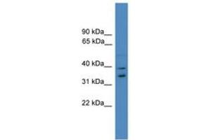 Image no. 1 for anti-Ubiquitin Fusion Degradation Protein 1 Homolog (UFD1L) (AA 161-210) antibody (ABIN6745307) (UFD1L 抗体  (AA 161-210))