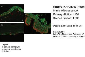 Image no. 2 for anti-Retinoblastoma Binding Protein 9 (RBBP9) (N-Term) antibody (ABIN2775962) (RBBP9 抗体  (N-Term))