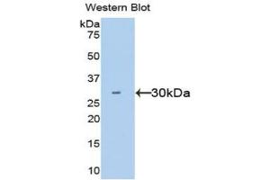Western blot analysis of the recombinant protein. (HGF 抗体  (AA 495-728))