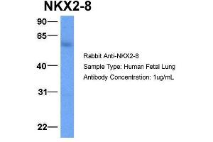 Host:  Rabbit  Target Name:  NKX2-8  Sample Type:  Human Fetal Lung  Antibody Dilution:  1. (NKX2-8 抗体  (C-Term))