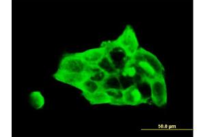 Immunofluorescence of monoclonal antibody to DSC3 on A-431 cell. (Desmocollin 3 抗体  (AA 585-684))