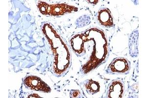 Formalin-fixed, paraffin-embedded human skin stained with Cytokeratin 18 antibody (KRT18/834). (Cytokeratin 18 抗体)