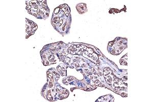 Immunohistochemistry of paraffin-embedded human placenta using PD-L1/CD274 Rabbit pAb (ABIN6129976, ABIN6138153, ABIN6138154 and ABIN6215142) at dilution of 1:100 (40x lens). (PD-L1 抗体  (AA 19-238))