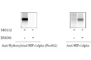 HeLa cells were treated or untreated with MG132 and DMOG. (Hydroxylated HIF-1 alpha (P402) ELISA 试剂盒)