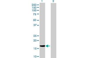 Western Blotting (WB) image for anti-Heat Shock 27kDa Protein Family, Member 7 (Cardiovascular) (HSPB7) (AA 1-170) antibody (ABIN525858)