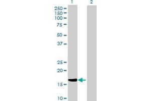Western Blot analysis of HSPB7 expression in transfected 293T cell line by HSPB7 MaxPab polyclonal antibody. (HSPB7 抗体  (AA 1-170))