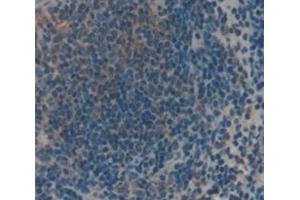 Immunohistochemistry (IHC) image for anti-Transient Receptor Potential Cation Channel, Subfamily V, Member 2 (TRPV2) (AA 1-264) antibody (ABIN1871964)