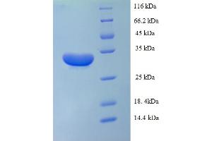 SDS-PAGE (SDS) image for Interleukin 1 alpha (IL1A) (AA 113-271) protein (His-SUMO Tag) (ABIN5709737)
