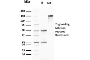 SDS-PAGE Analysis Purified AKT1 Mouse Monoclonal Antibody (AKT1/2784). (BARX1 抗体)