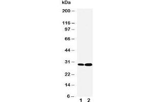 Western blot testing of LASP1 antibody and Lane 1:  HeLa;  2: MCF-7 cell lysate. (LASP1 抗体  (C-Term))
