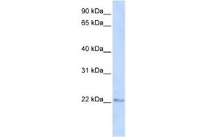 C6ORF64 antibody used at 1 ug/ml to detect target protein. (SAYSD1 抗体  (C-Term))