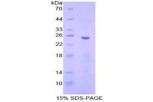 SDS-PAGE analysis of Human IKBIP Protein. (IKbIP 蛋白)
