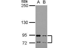 WB Image Sample (30 ug of whole cell lysate) A: Raji B: K562 5% SDS PAGE antibody diluted at 1:1000 (FCAR 抗体)