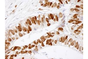 Immunohistochemistry (IHC) image for anti-Minichromosome Maintenance Complex Component 2 (MCM2) (pSer41) antibody (ABIN7448648)