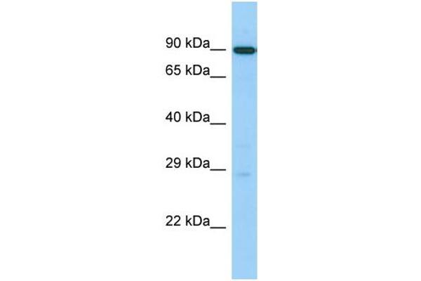 UTP14C 抗体  (C-Term)
