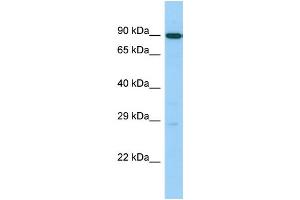 Host: Rabbit Target Name: UTP14C Sample Type: 721_B Whole Cell lysates Antibody Dilution: 1. (UTP14C 抗体  (C-Term))