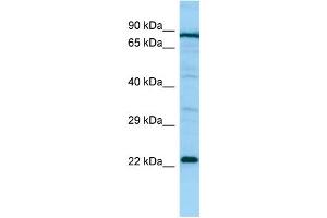WB Suggested Anti-PTGES2 Antibody Titration: 1. (PTGES2 抗体  (Middle Region))