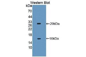 Western blot analysis of the recombinant protein. (NAIP 抗体  (AA 500-759))