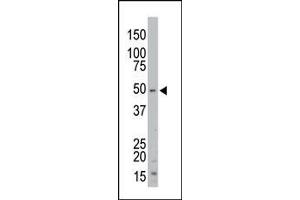 The anti-STK35 Pab (ABIN391361 and ABIN2841380) is used in Western blot to detect STK35 in mouse kidney tissue lysate. (STK35 抗体  (AA 374-404))