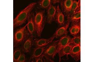 IF analysis of Cdc25C using anti-Cdc25C antibody (ABIN3042352) and anti-Tubulin Alpha antibody (ABIN7600339). (CDC25C 抗体  (AA 175-473))