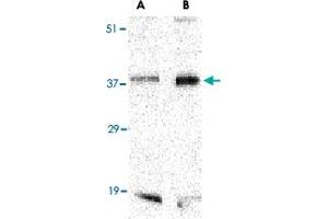 Western blot analysis of BAG1 in PC-3 cell lysate with BAG1 polyclonal antibody  at (A) 1 and (B) 2 ug/mL . (BAG1 抗体  (C-Term))